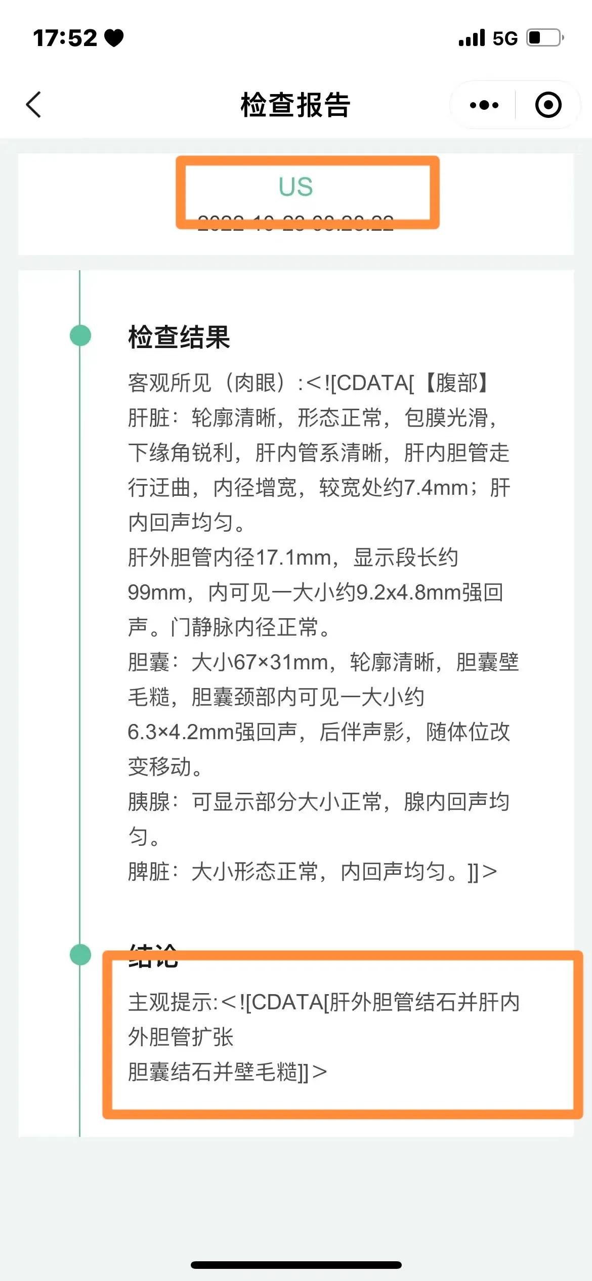 上火会导致尿液发黄吗,小便发黄是体内有火吗