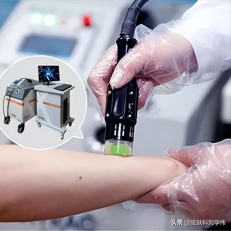 自己在家用白癜风光疗仪,在家治疗白癜风最好的效果