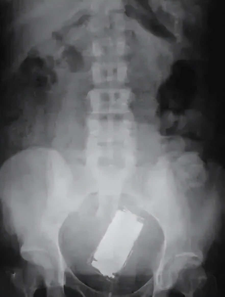 这些东西都能塞进身体里？就离谱