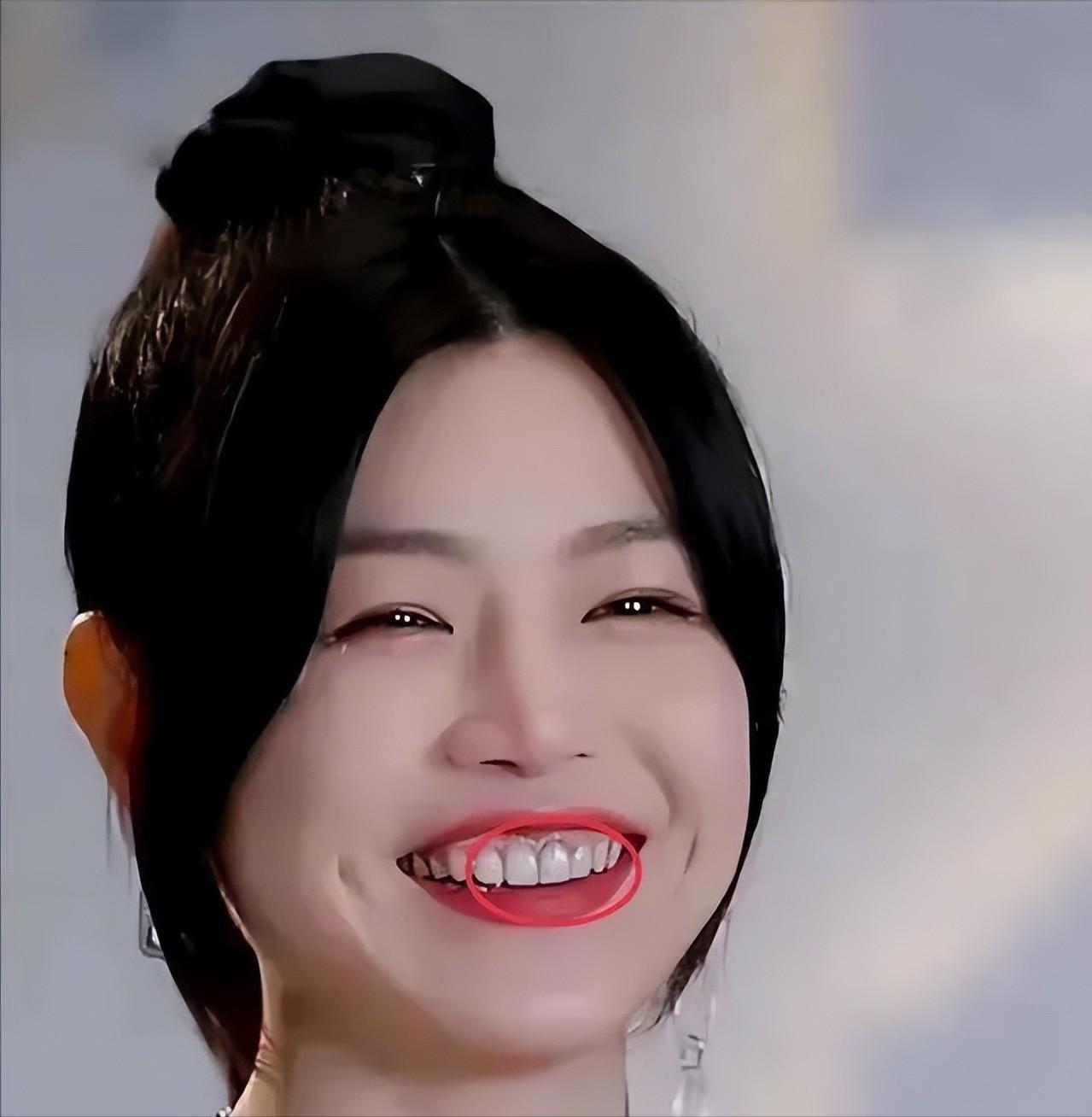 假发，假臀，假肌肉？明星“好皮囊”下，是眼见不一定为实的真相