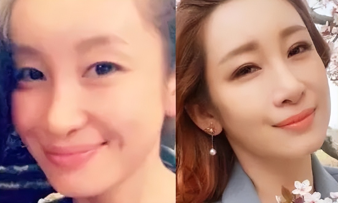 割双眼皮像变了个人,割了双眼皮像变了个人