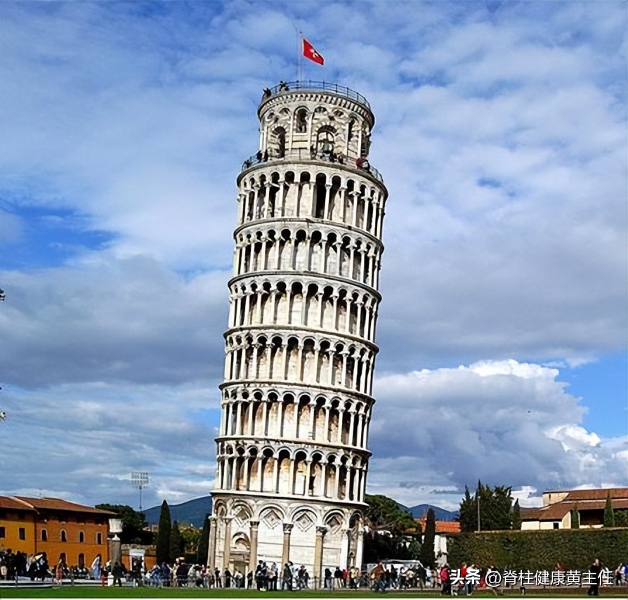 扁平足o型腿骨盆前倾高低肩,一只脚是扁平足怎么矫正