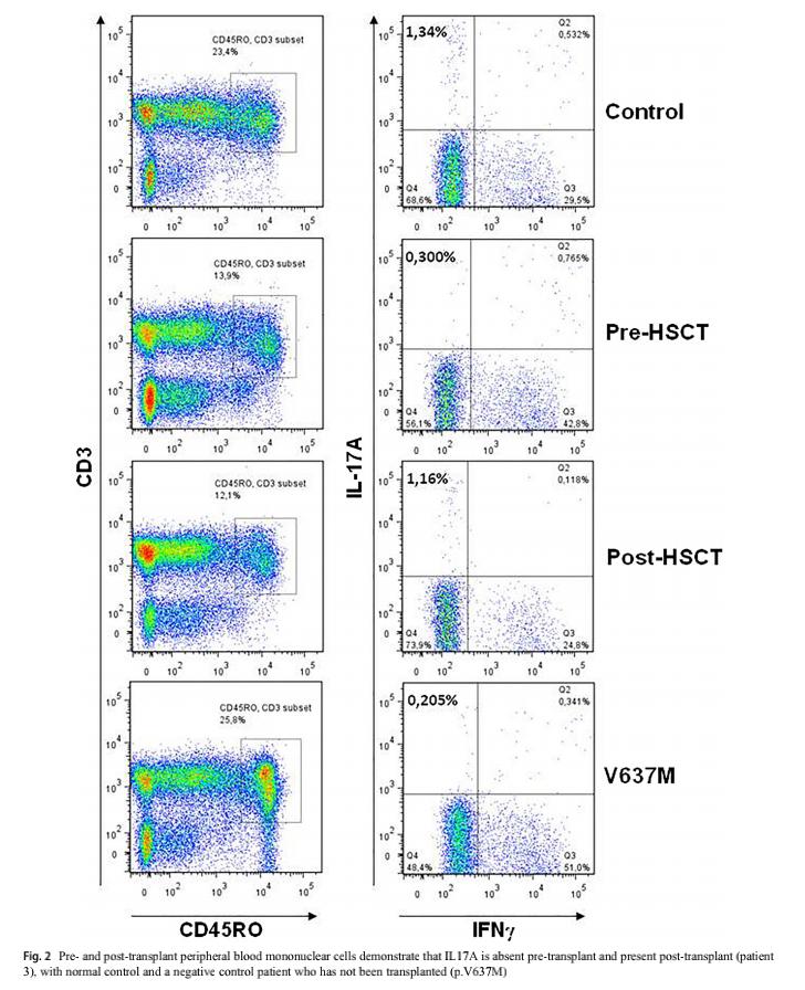 免疫缺陷病会并发什么病,什么是免疫缺陷肺部感染