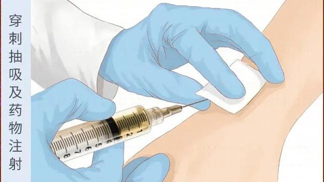 手背上长了个小凸起的包不痛不痒,手背突然起了个包