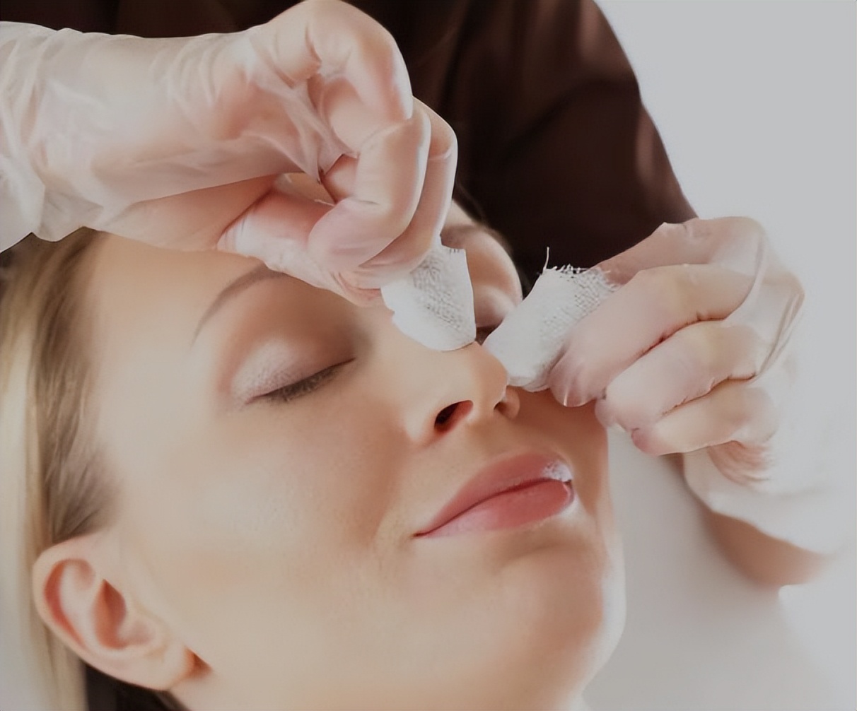 鼻子上螨虫挤出来的窟窿怎么办,鼻子里的螨虫有腥臭味是怎么回事