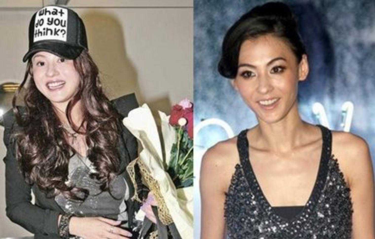 心慌、脱发、牙齿掉光，明星为瘦身花招百出，却被减肥后遗症折磨