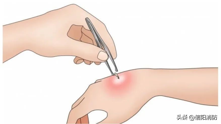 夏季到来当心蛇出没,夏季提防虫子