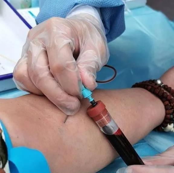 17岁女孩感染了hiv怎么办,女hiv患者传染给男性概率