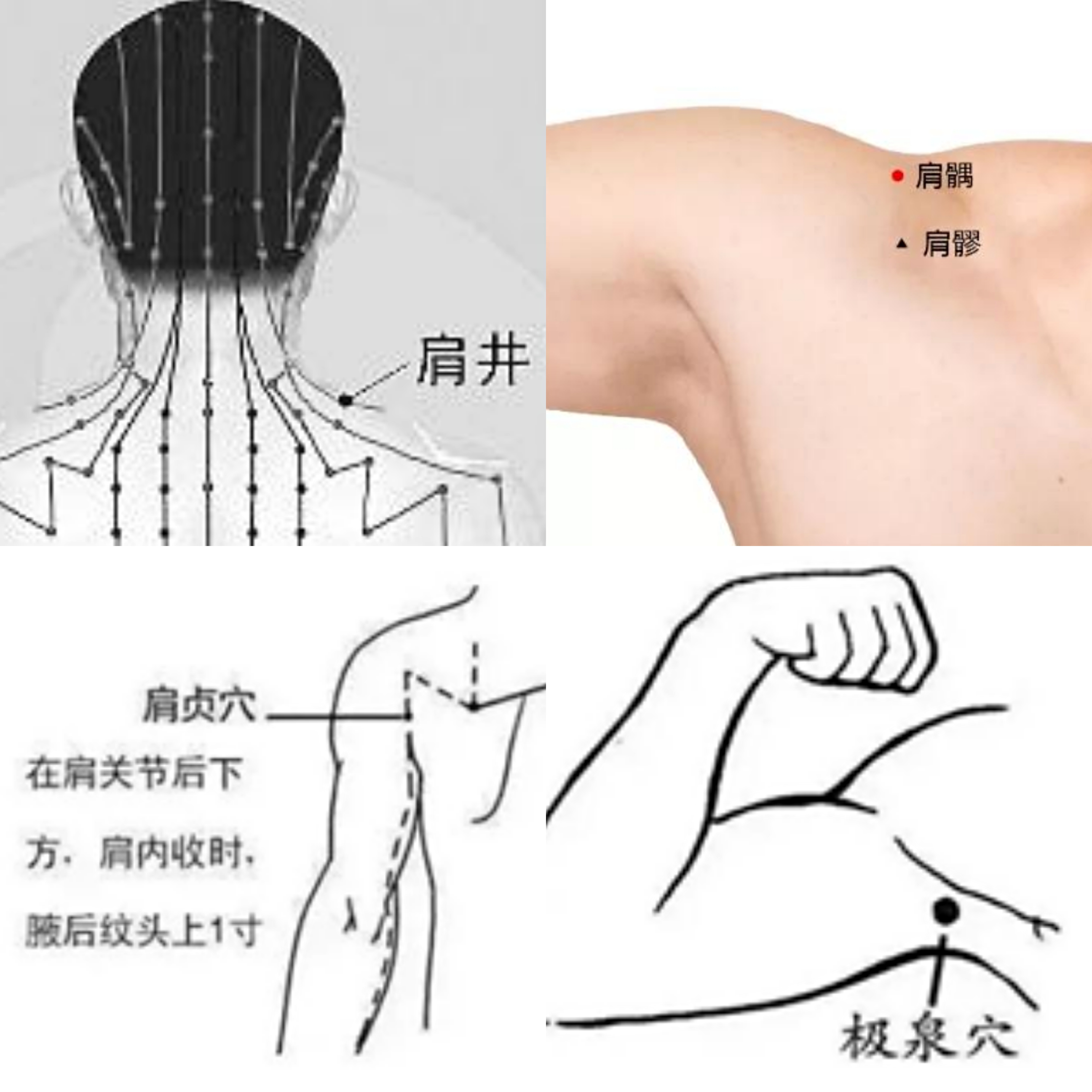 得了肩周炎吃什么药治疗效果最好,肩周炎针灸治疗最好最有效的穴位