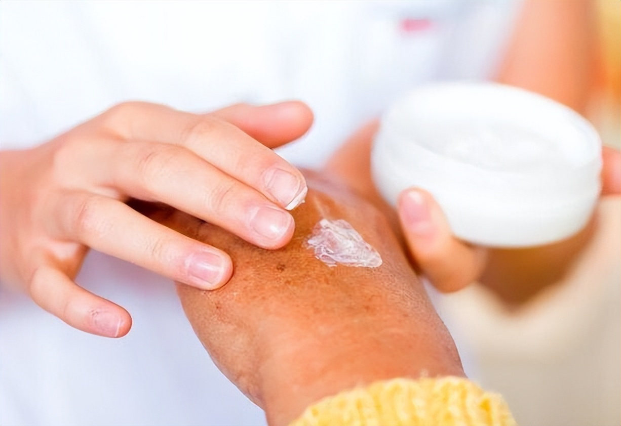 2块钱的红霉素软膏有淡斑效果吗,红霉素软膏的淡斑方法真实测评