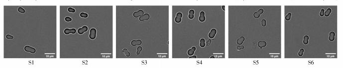 发酵液的提取常用方法,发酵液提取分离的主要方法