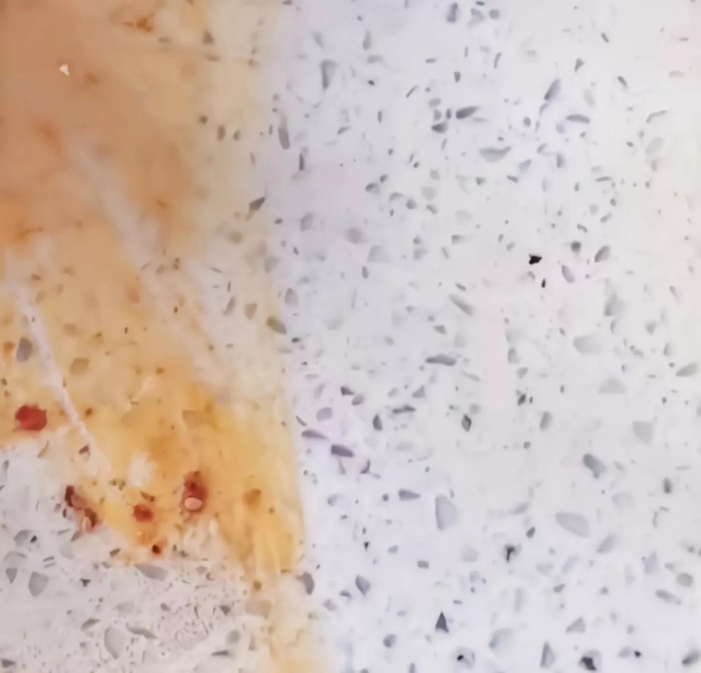 贴创可贴过敏又肿又痒妙招,防晕车小妙招最简单创可贴