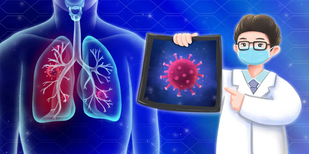 放疗后肺纤维化怎么办,放疗后肺间质纤维化吃什么药治疗