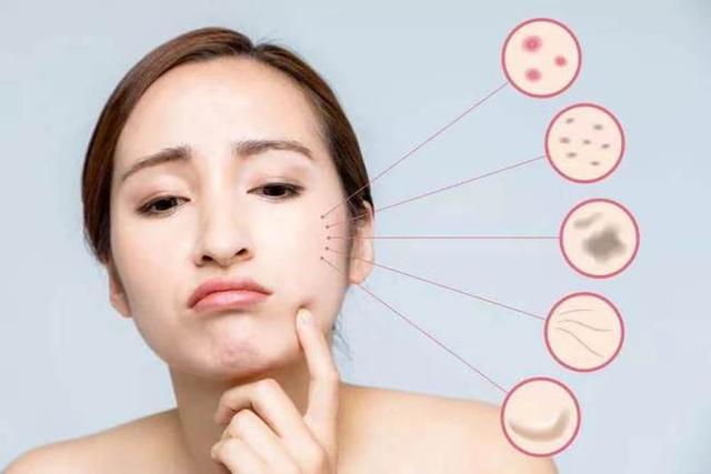 吃什么药可以缓解皮肤干燥,缓解皮肤干燥的最好的办法