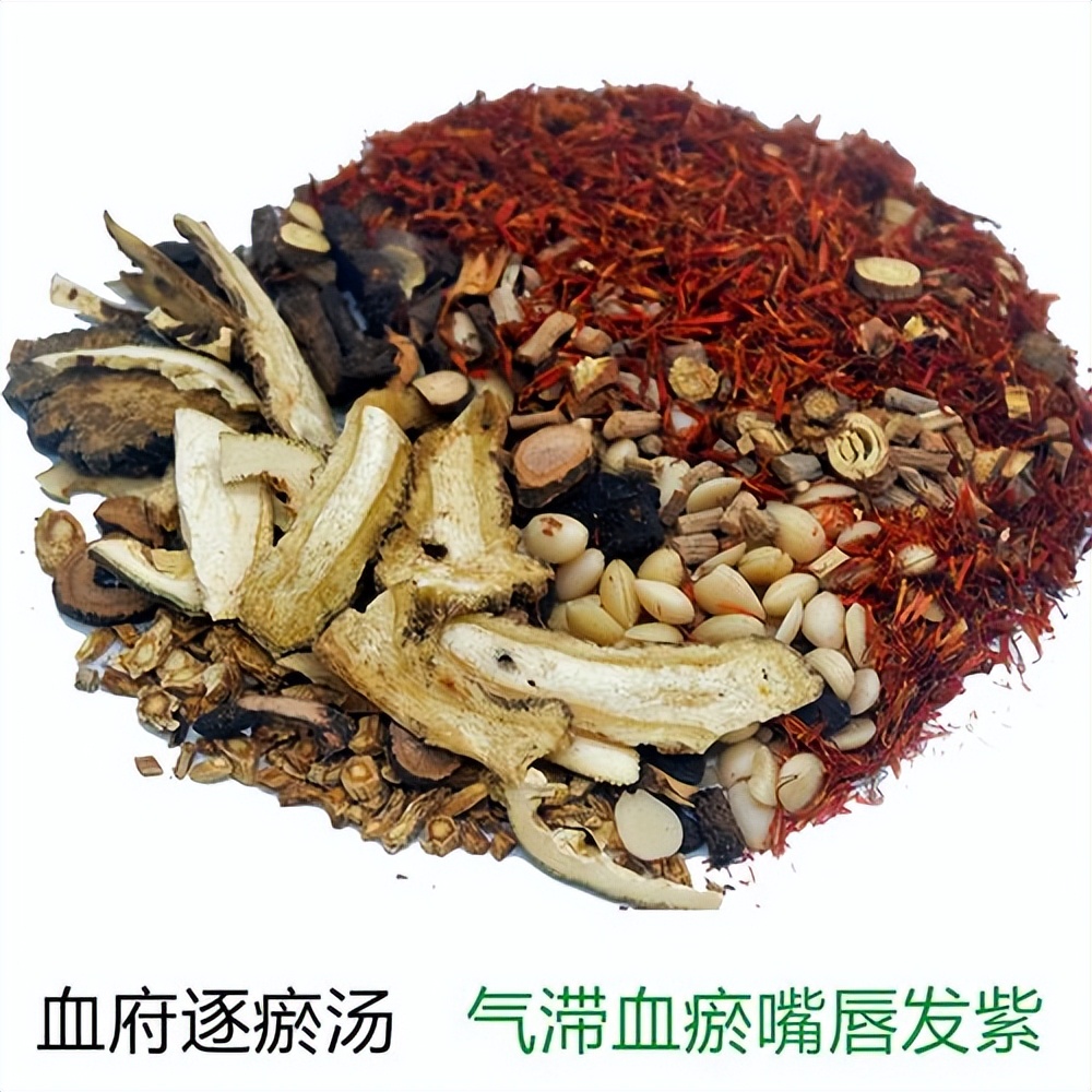 舌下有青筋就是有血瘀吗,舌下青筋是血瘀体质的症状