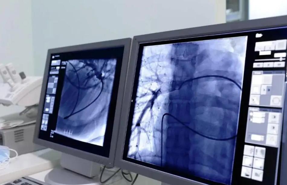 做完冠脉造影，病人就活不久了？冠脉造影检查对人体有什么危害？