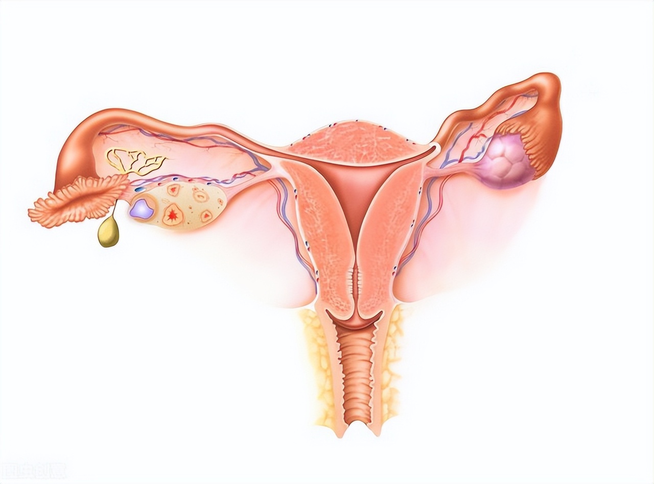 为什么月经期一直头疼,为什么月经期全身关节疼