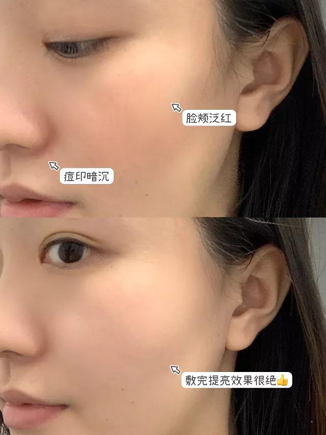 四效合一瘦身方案,四效合一全新升级