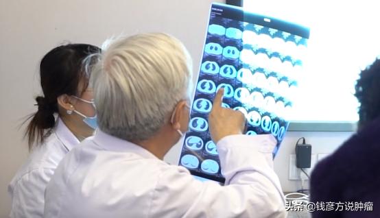 乳腺癌术后肺转移39例临床分析,乳腺癌肺转移化疗多长时间见效