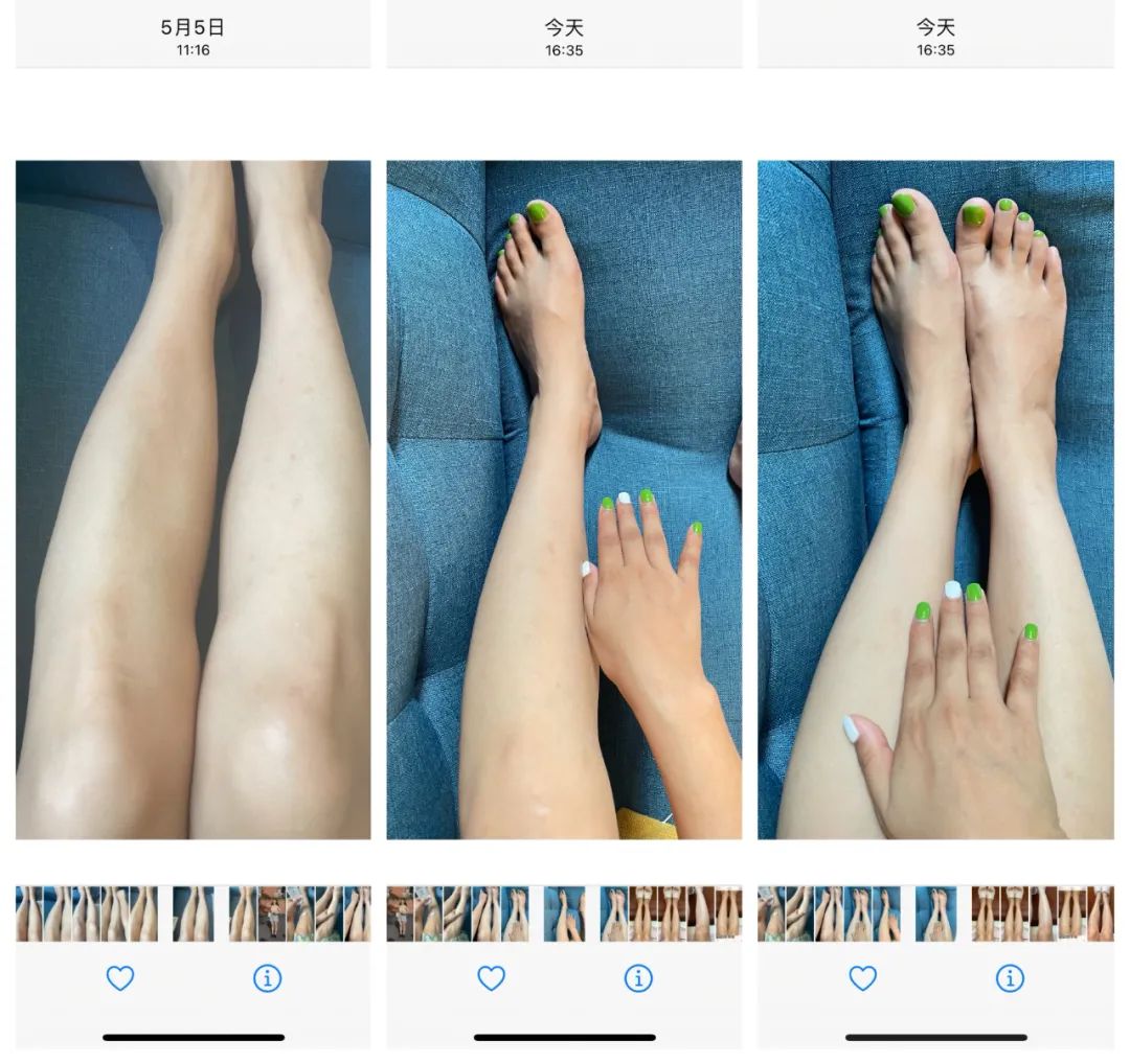 暑假一个月黄黑皮如何美白,天生黑皮的美白项目