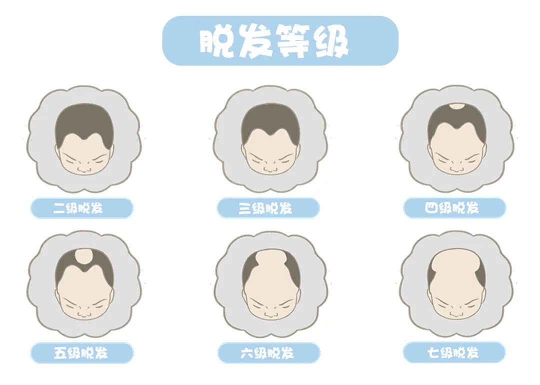 洗发水应该如何挑选,洗发水到底怎么选