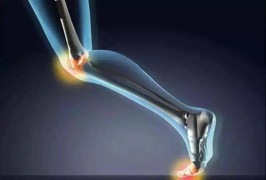 风湿痹阻辨证分析,风湿热痹的中医辨证分析