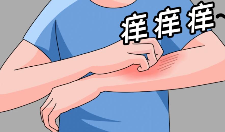 你以为的皮肤病却成了艾滋病，若出现这4种症状，说明病入膏肓了