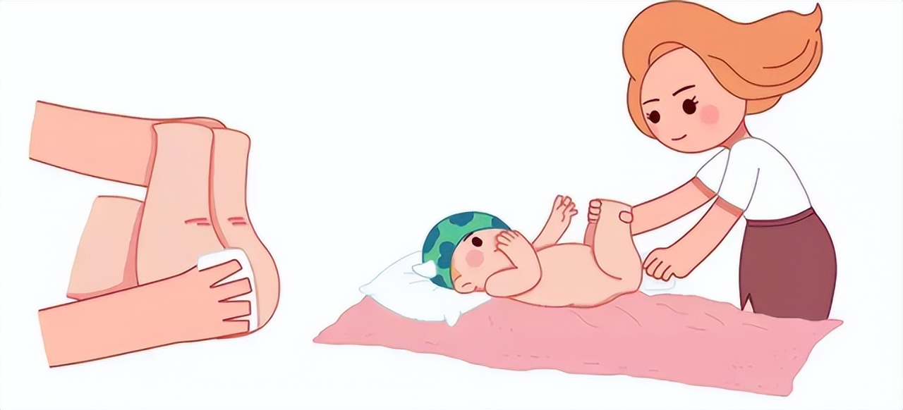 你会一直坚持“洗屁屁”吗？医生告诉你经常洗屁屁的益处，来看看