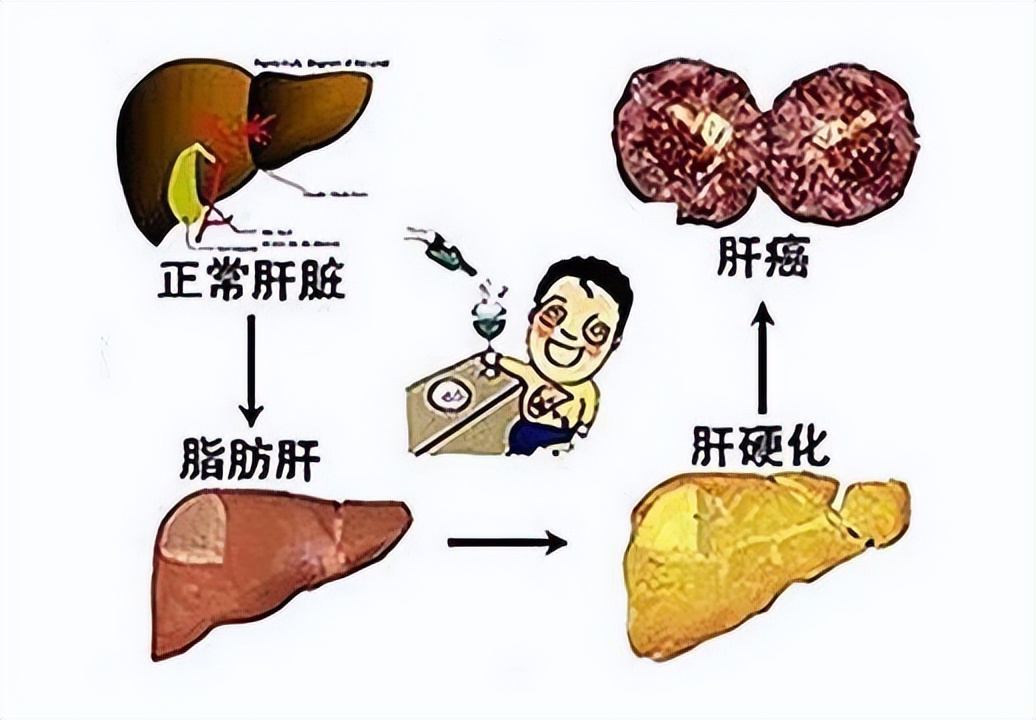 肝脏肿瘤一般长到5cm要几年,肝脏肿瘤几公分会有症状