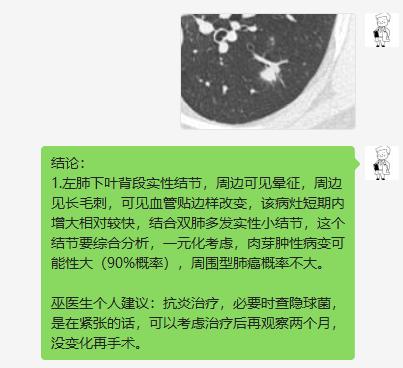 肺结节进一步检查排除肿瘤,肺结节4mm报告建议复查