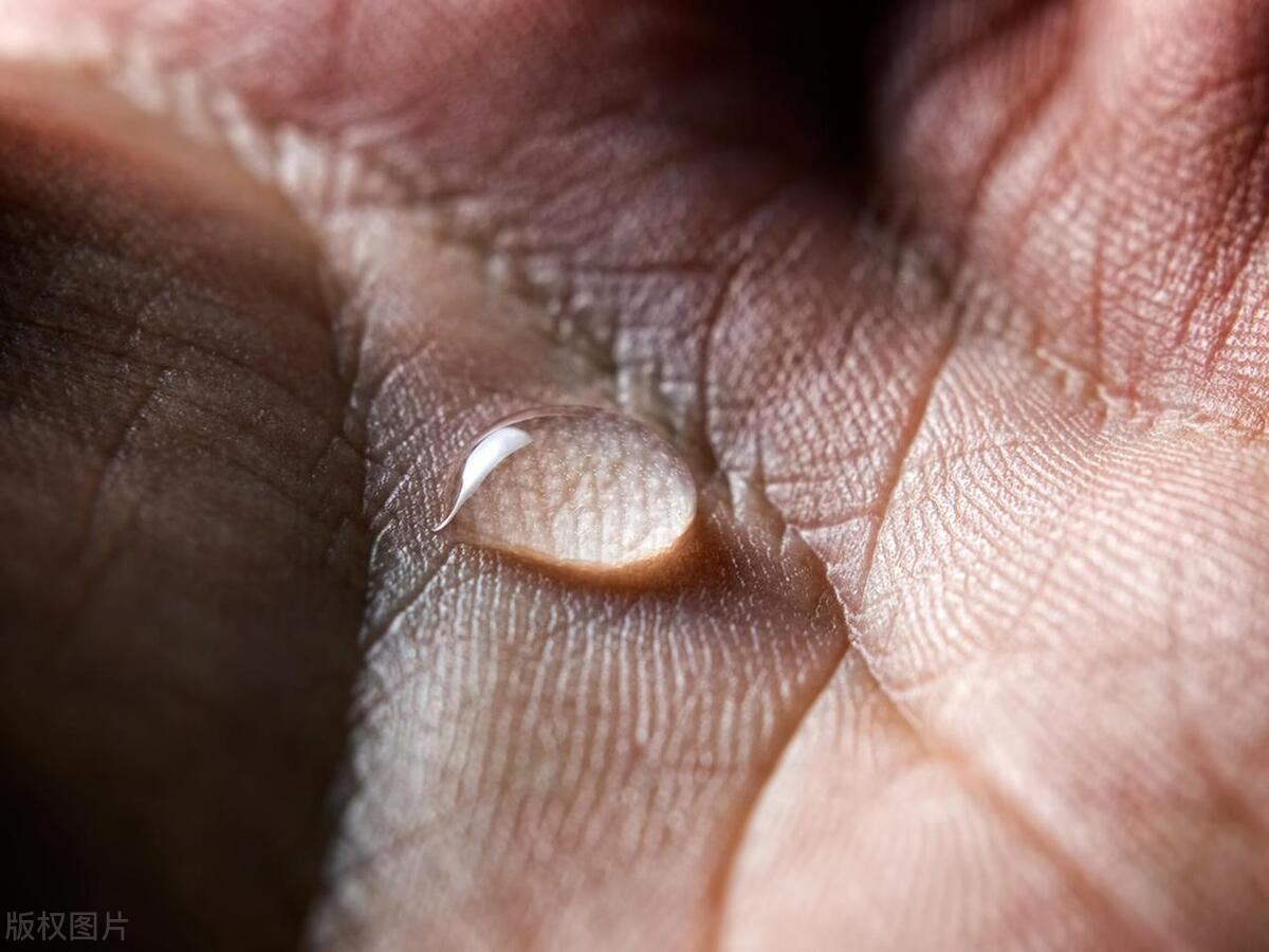 得了慢性湿疹该注意什么,慢性湿疹持续发作如何除根