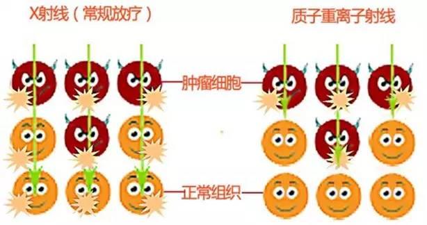 腮腺腺样囊性癌属于哪类癌症,腺样囊性癌属于什么级别的癌