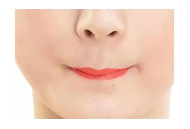 嘴唇干燥起皮中医怎么治疗最有效,冬天嘴唇干燥起皮嘴角发炎怎么办