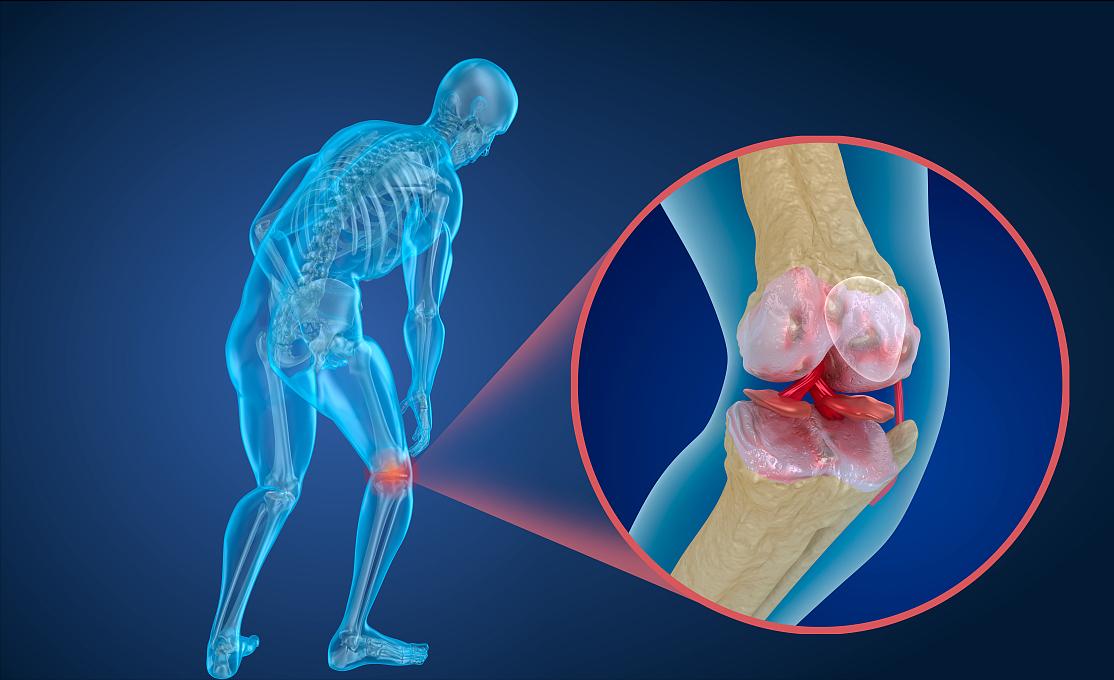 老年人怎么预防髋关节骨折,老年人易骨折怎么预防