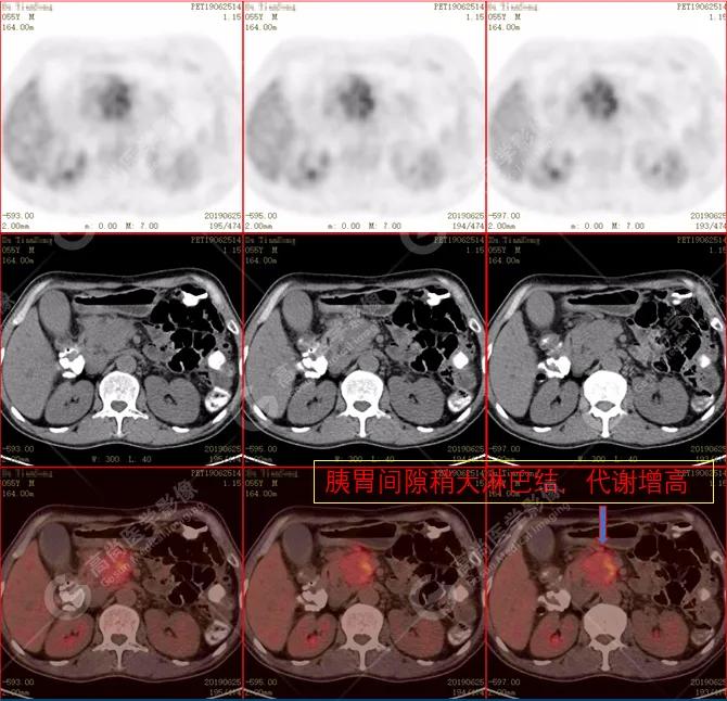 皮肤巩膜黄染无腹痛,腹部皮肤出现黄染
