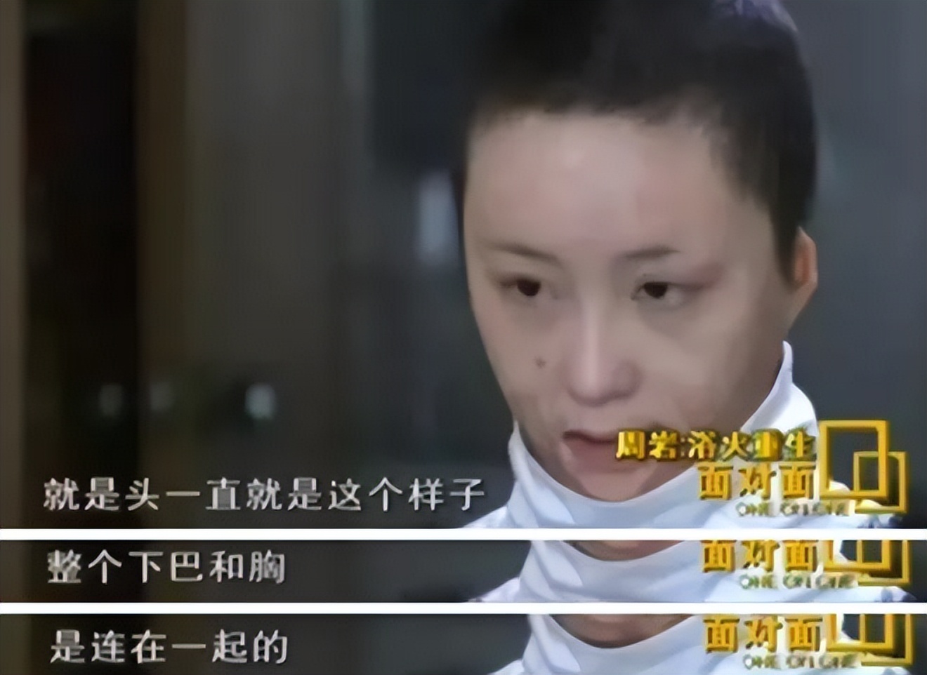 16岁女孩拒绝官二代求爱被毁容,拒绝富二代追求遭毁容以前照片