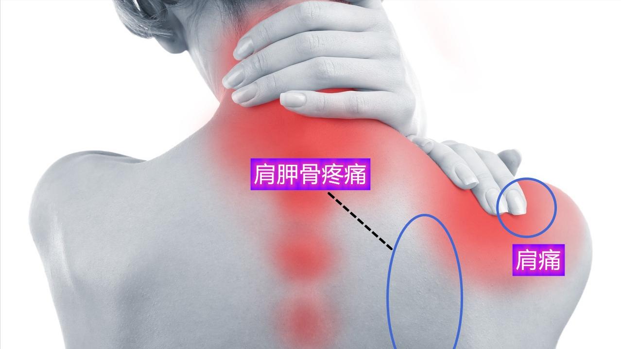 颈椎病做了手术为什么会肩膀疼,颈椎引起肩周疼痛是否用针扎