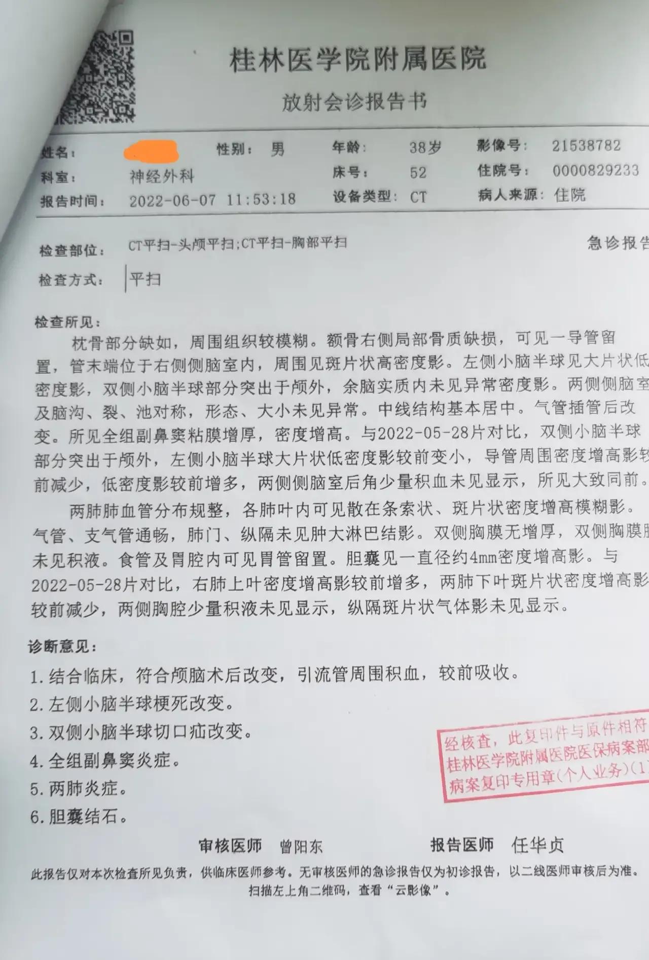 大面积脑梗中风康复案例,脑梗康复的真实经历