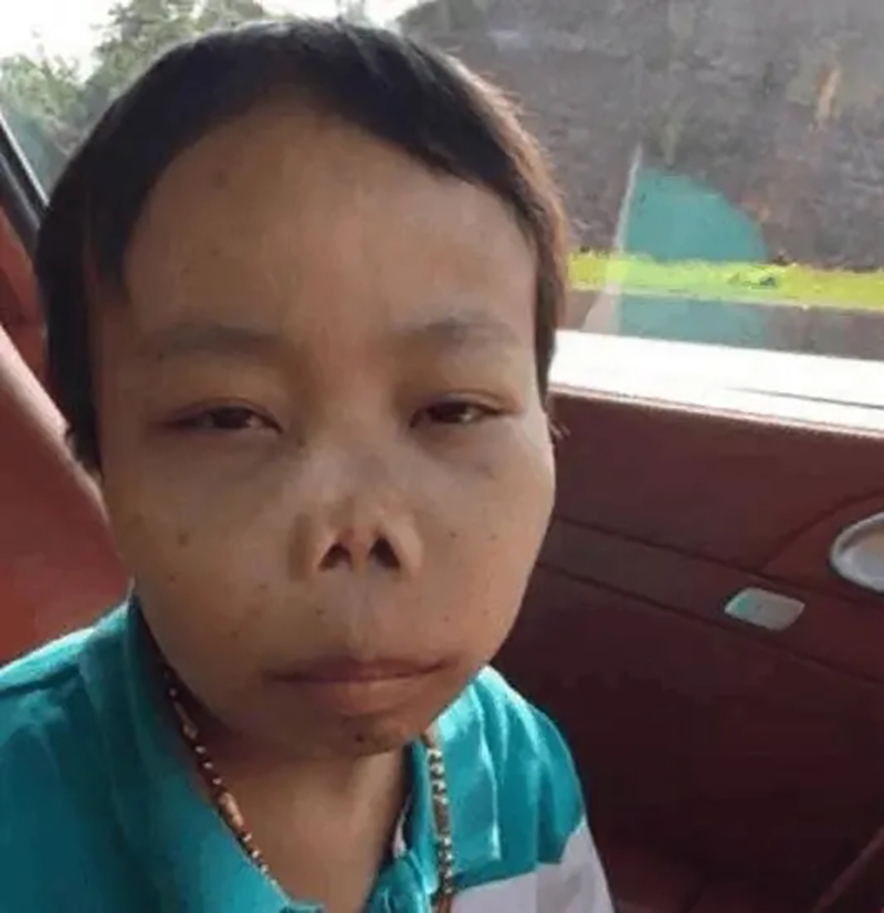 农村娃陈山,最丑网红陈山现状