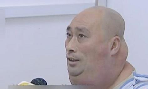 辽宁男子喝3万斤酒撑大脖子,男子嗜酒如命一天三四斤白酒