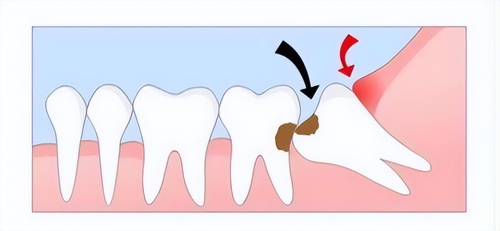 几元钱的甲硝唑能摆平五种病,几块钱一瓶的甲硝唑有什么作用