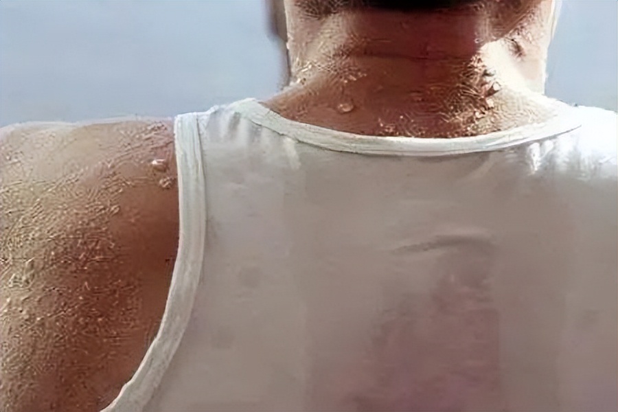 小孩晚上睡觉头部出汗中医辨证,头部出汗的中医辨证