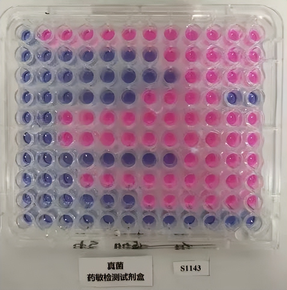 健康科普勤洗手,健康科普和结核病相关的