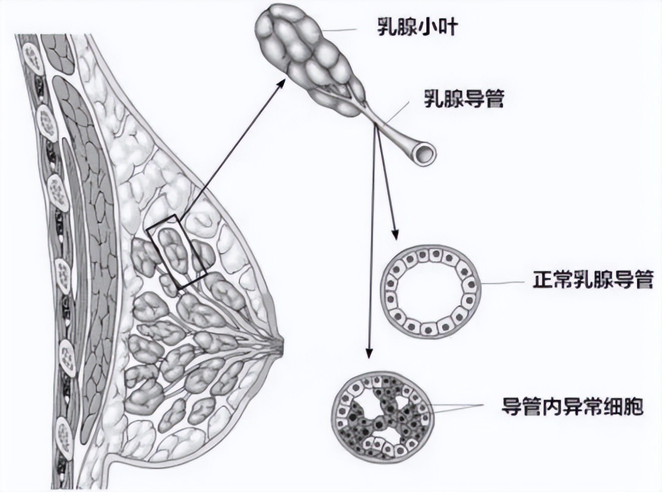 什么叫恶性肿瘤内分泌治疗,肿瘤内分泌治疗的药物有哪些