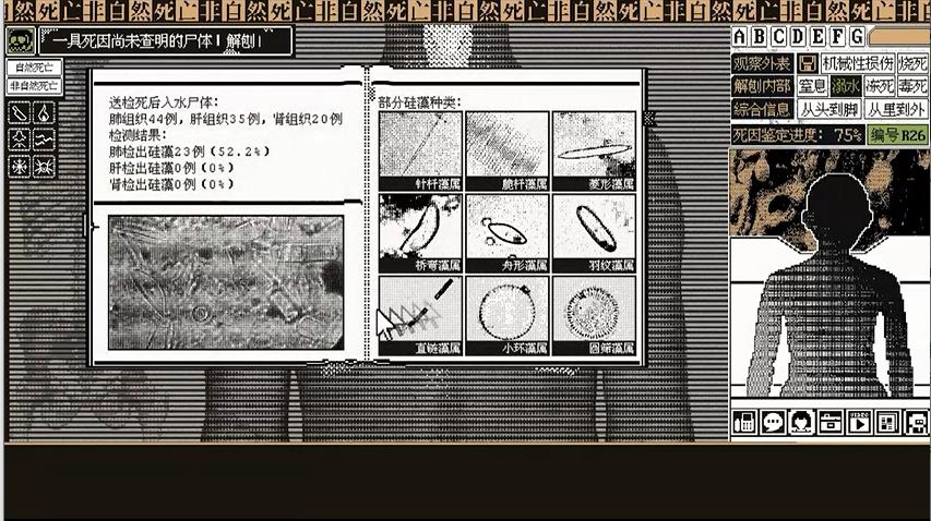 非自然死亡七大死因,自然死亡的具体死因