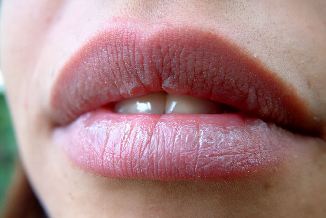 孩子嘴唇发白脾胃虚弱怎么食疗,脾胃虚弱湿热舌苔厚发黄怎么调理