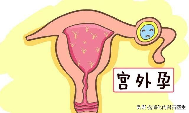 大出血流产女子肚子疼,流产后子宫穿孔