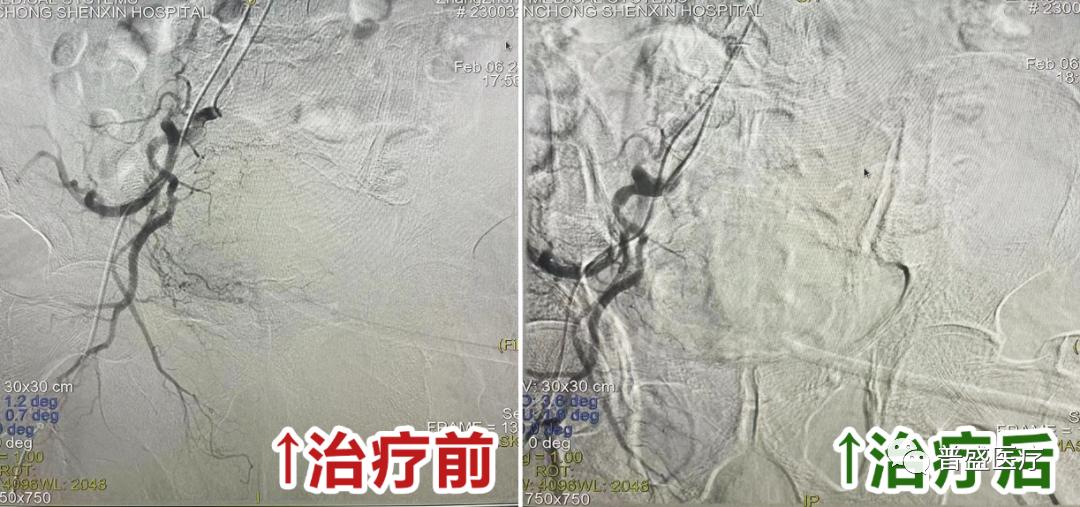 南充治肿瘤最好的医院,南充哪家医院治肿瘤好