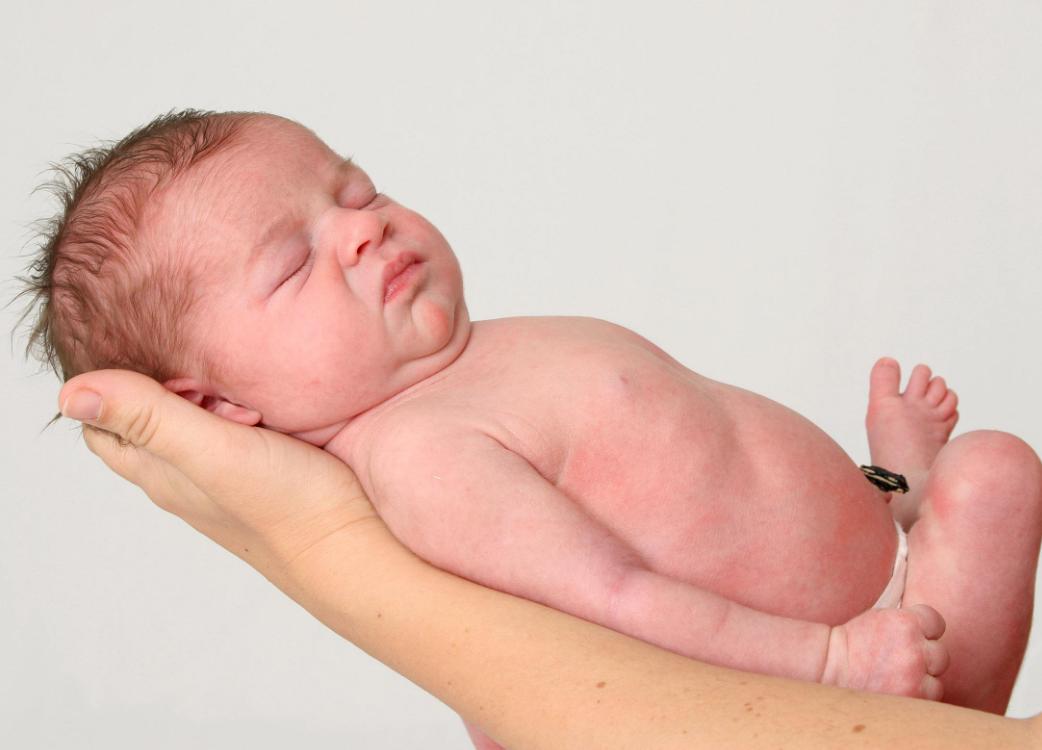 如何预防婴幼儿缺铁性贫血的发生,吃什么食物可以预防缺铁性贫血