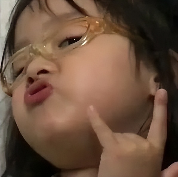 一抓头皮指甲里就有白泥怎么办,头皮一抓指甲里都是白泥